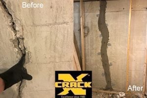 before after